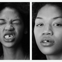 Model 21 tahun ini menjadi terkenal justru ketika ia menjadi bahan lelucon di dunia maya. Sebuah akun Twitter kala itu mengejeknya karena memiliki gigi ompong saat tersenyum. Foto: Instagram @symone_lu