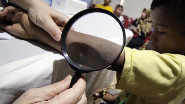 Warga Antusias Periksa Kesehatan Kulit