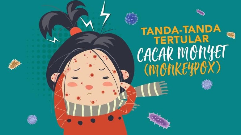 Heboh Cacar Monyet, Warga Diminta Tetap Tenang Heboh Cacar Monyet, Warga Diminta Tetap Tenang
