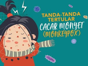 Heboh Cacar Monyet, Warga Diminta Tetap Tenang