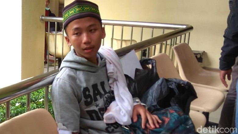 Cerita Korban Ricuh di Tanah Abang: Niat Menolong Malah Kena Molotov Cerita Korban Ricuh di Tanah Abang: Niat Menolong Malah Kena Molotov