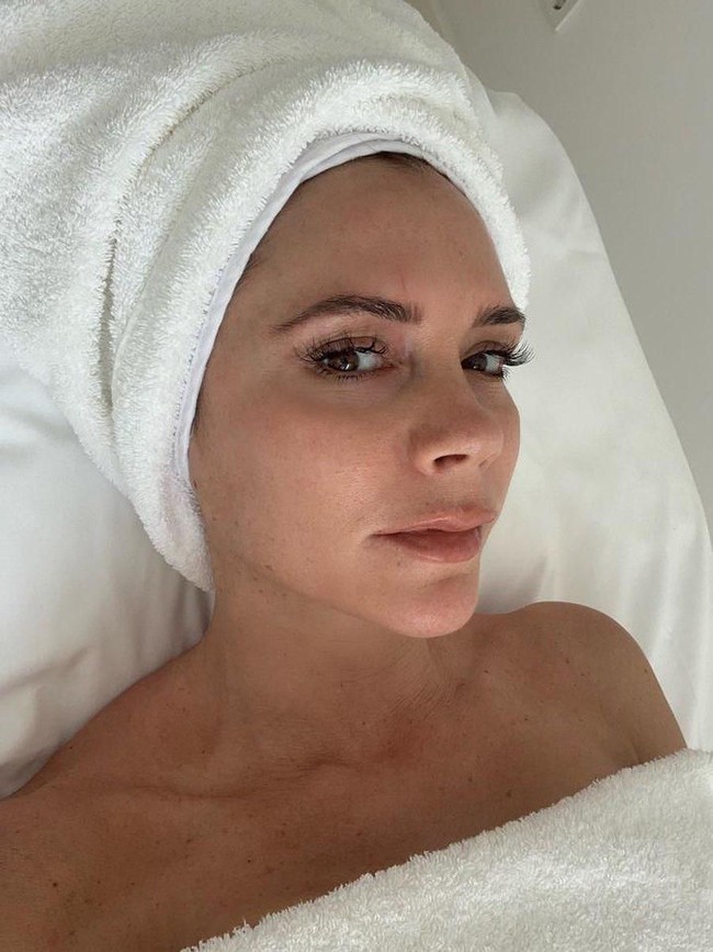 Victoria Beckham adalah salah satu artis yang juga pernah mengalami masalah jerawat. Kamu mungkin tidak akan menduganya karena kulitnya sekarang yang terlihat jauh lebih mulus dan glowing. Bahkan, Victoria mengungkapkan kepada majalah Net-a-Porter bahwa dulu dirinya sampai mengunjungi dokter kulit untuk mengobati jerawatnya tersebut. Ternyata, rahasia istri dari David Beckham itu untuk sembuh dari jerawat adalah dengan banyak mengonsumsi salmon. Dirinya mengonsumsi salmon setiap hari, untuk sarapan, makan siang, hingga makan malam. Ini karena salmon kaya akan kandungan asam lemak omega 3 yang dapat mencegah peradangan pada tubuh. Foto: istimewa