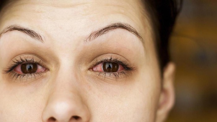 Luapan emosi dengan menanis bisa membakar kalori. (Foto: iStock) Luapan emosi dengan menanis bisa membakar kalori. (Foto: iStock)