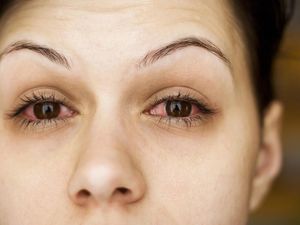 Studi Sebut Menangis di Jam 7-10 Malam Bisa Bantu Turunkan Berat Badan