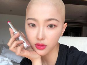 Potret Manis Dawn Lee, Beauty Vlogger Berkepala Botak karena Sakit Kanker