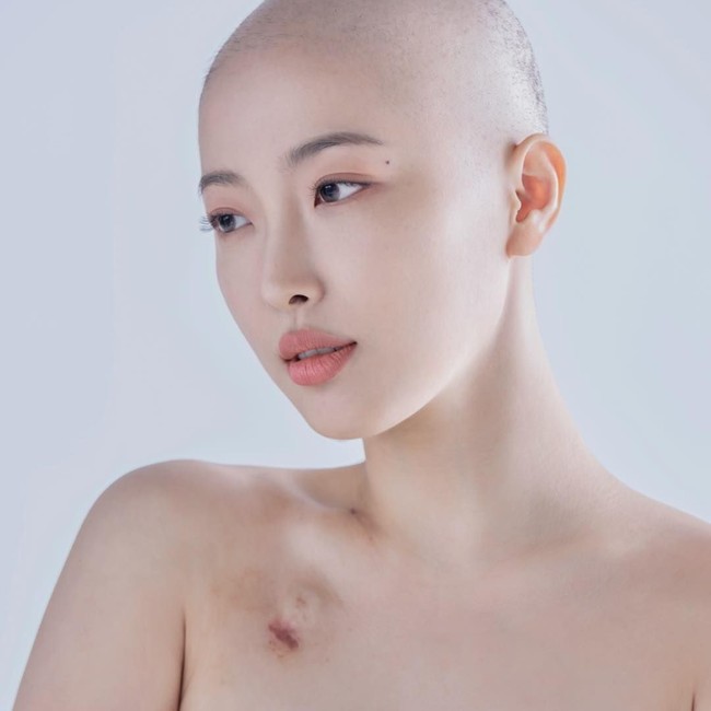 Dawn Lee punya semangat hidup yang tinggi. Dia didiagnosa kanker kelenjar getah bening pada Februari silam, namun ia menunjukkan semangatnya yang tinggi. Foto: dok. Instagram