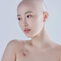 Dawn Lee punya semangat hidup yang tinggi. Dia didiagnosa kanker kelenjar getah bening pada Februari silam, namun ia menunjukkan semangatnya yang tinggi. Foto: dok. Instagram