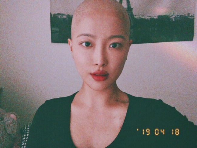 Semangatnya ini bikin netizen terharu. Meski sakit, namun Dawn selalu tersenyum dan masih bisa bercanda dengan orang sekitarnya. Seperti saat momen dia menggunduli rambutnya di salon. Kepada hair stylisthnya, Dawn sempat bercanda bahwa bentuk kepalanya kini mirip kiwi. Foto: dok. Instagram