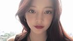 Alasan Goo Hara Bunuh Diri dan Kondisi Terkininya