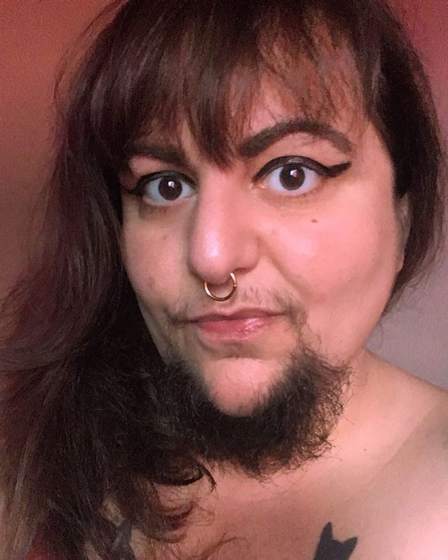 Schwarz tentu saja pernah terjebak dengan rasa tidak percaya diri. Hingga ia setiap harinya harus mencukur bulu-bulu di area tubuhnya.  Foto: Instagram @thisislittlebear