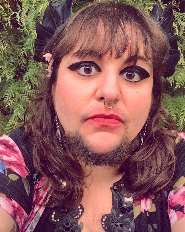 Di usia 14 tahun, Little Bear Schwarz mengalami gangguan hormonal. Ia mengidap sindrom ovarium polikistik yang membuat tumbuh bulu di tubuhnya.  Foto: Instagram @thisislittlebear