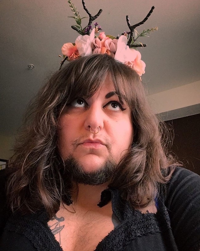 Masa mudaku dilalui dengan sangat sulit. Aku menghabiskan banyak waktu untuk menutupinya, ujar Schwarz dalam acara This Morning di ITV. Foto: Instagram @thisislittlebear