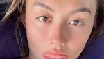 Dituding Tanam Benang, Ini Transformasi Wajah Agnez Mo
