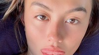 Agnez Mo dituding lakukan tanam benang usai mengunggah foto selfie dirinya di instagram. Dok. Instagram/agnezmo