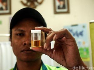 Sopir Bus Jalani Tes Kesehatan di Terminal Grogol