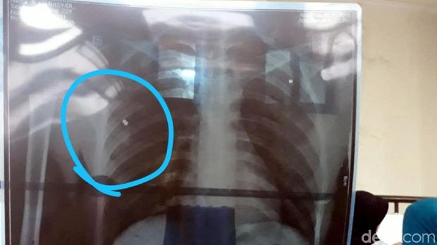 Aksi Koboi Teror Sukabumi, Korban: Semoga Pelaku Cepat Ditangkap