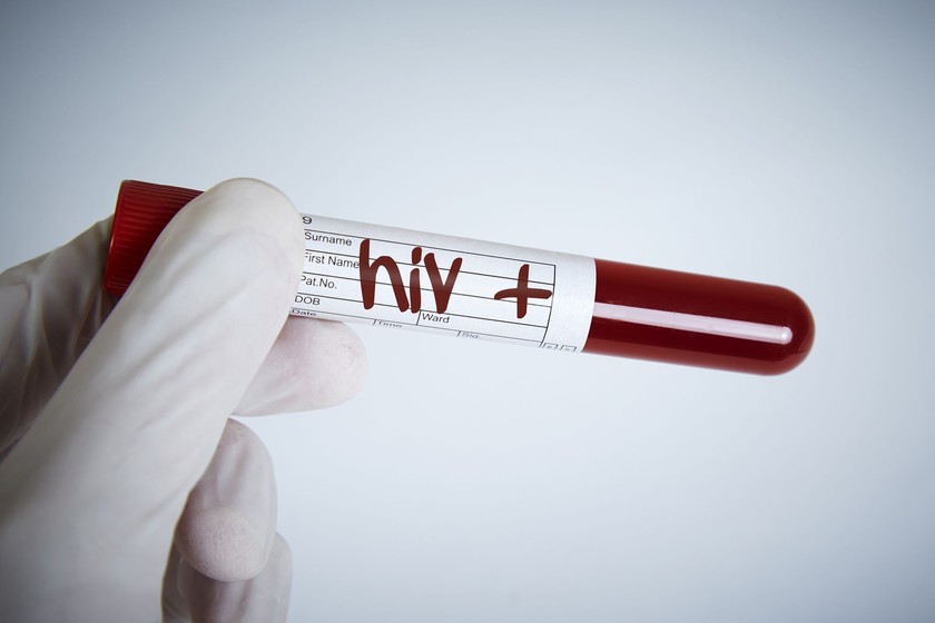 Gejala HIV Bikin Overthinking