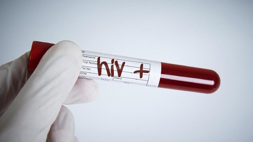 Laboratory Request, Hiv Test, Hiv Positive