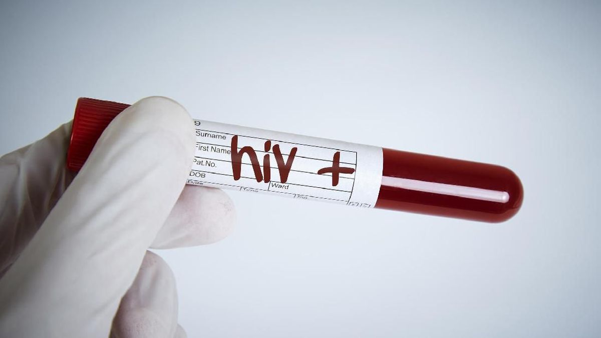 Ciri ciri Hiv - Januari 2023 9. Risiko penularan HIV