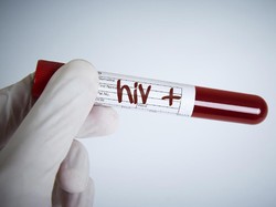 Terlalu Bucin, Remaja Nekat Suntik Tubuhnya dengan Darah HIV Milik Sang Pacar