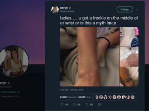 Viral Freckles Mirip di Pergelangan Tangan Wanita, Mitos atau Fakta?