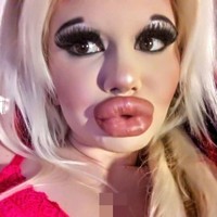 Mempertahankan penampilan hasil operasi plastiknya tentu tidak mudah. Andrea dilaporkan menyuntikkan asam hialuronat ke bibirnya dan melakukan filler kembali setiap kali ukurannya mulai berkurang. Sementara wanita yang berasal dari kota Burgas itu senang dengan hasilnya, namun ia mendapati kritik ketika mengunggah foto selfie secara online. Foto: Instagram