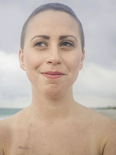 Racheli Alkobey, penyintas kanker darah