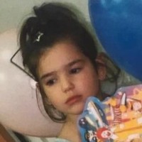 Tuduhan itu dipicu karena pada foto masa kecil sebelumnya, bibirnya terlihat berbeda dan lebih tipis. Namun bisa jadi bibirnya tampak lebih besar akibat efek cahaya atau bayangan. Foto: Instagram/@dualipa