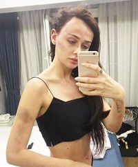 Penampilan Tanja yang penuh memar setelah dipukuli pacarnya