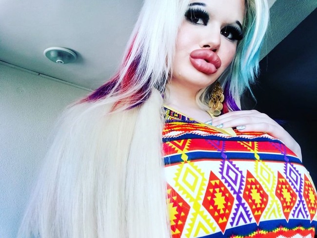 Sejak saya kecil, saya mencintai Barbie dan bermimpi tentang wajah yang sepertinya suatu hari. Saya melakukan lebih dari 15 prosedur sejak 2018. Saya tidak menghitungnya, mungkin ada lebih banyak, kata Andrea seperti dikutip Daily Star. Foto: Facebook