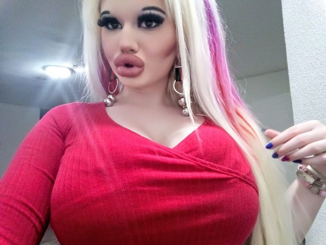 Hasil operasi plastik Andrea belum memuaskan semua orang, karena banyak kecaman dan komentar kejam yang menyebutnya monster dan Daffy Duck. Awalnya, wanita yang berasal dari Bulgaria ini mengubah dirinya dengan mendapatkan operasi plastik dan berharap lebih terlihat seperti boneka. Foto: Facebook