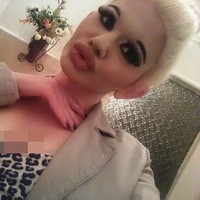 Meskipun Andrea telah menerima komentar kebencian, dia tidak menyesal telah melakukan operasi plastik. Setiap orang memiliki hak untuk hidup dan terlihat seperti yang mereka inginkan, tidak perlu bagi setiap orang untuk memenuhi standar yang dipaksakan oleh orang lain, terang Andrea Foto: Facebook