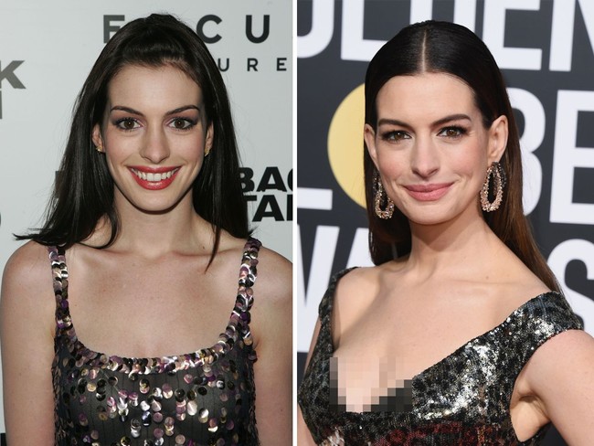 Anne Hathaway sudah belasan tahun berkarier sebagai aktris Hollywood. Bisa dilihat jika penampialn wanita ini justru semakin cantik dari hari ke hari. Foto: Getty Images