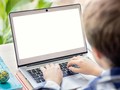 Keseringan Pakai Laptop di Pangkuan, Kulit Bocah Ini Gosong