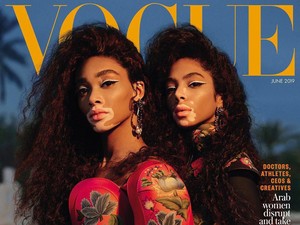Pertamakalinya 2 Model dengan Kulit Belang Jadi Sampul Majalah Vogue Arab