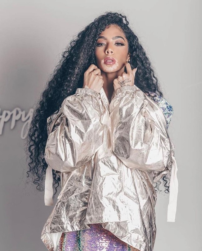 Sosok Shahad Salman tentu bukan model biasa jika dilihat dari penampilannya. Tampil bersama Winnie Harlow, jebolan Americas Next Top Model yang mendunia karena kondisi kulit vitiligo, Shahad memiliki keadaan kulit serupa dengannya. Foto: Instagram @5sunshine1, Vogue Arabia