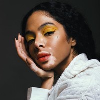 Shahad Salman tidak lagi malu menampilkan kondisi kulitnya yang vitiligo. Vitiligo adalah kelainan kulit yang menyebabkan depigmentasi tak merata sehingga tampak belang. Kondisi ini tidak menular. Foto: Instagram @5sunshine1, Vogue Arabia