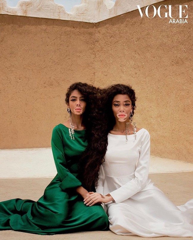 Dengan menyatukan Shahad dan Winnie sebagai model sampul, Vogue Arabia berharap kisah mereka bisa membuat wanita-wanita di Arab lebih berdaya dan keberadaan dua wanita ini mewakili wanita-wanita lainnya yang tubuhnya juga tidak sempurna. Foto: Instagram @5sunshine1, Vogue Arabia