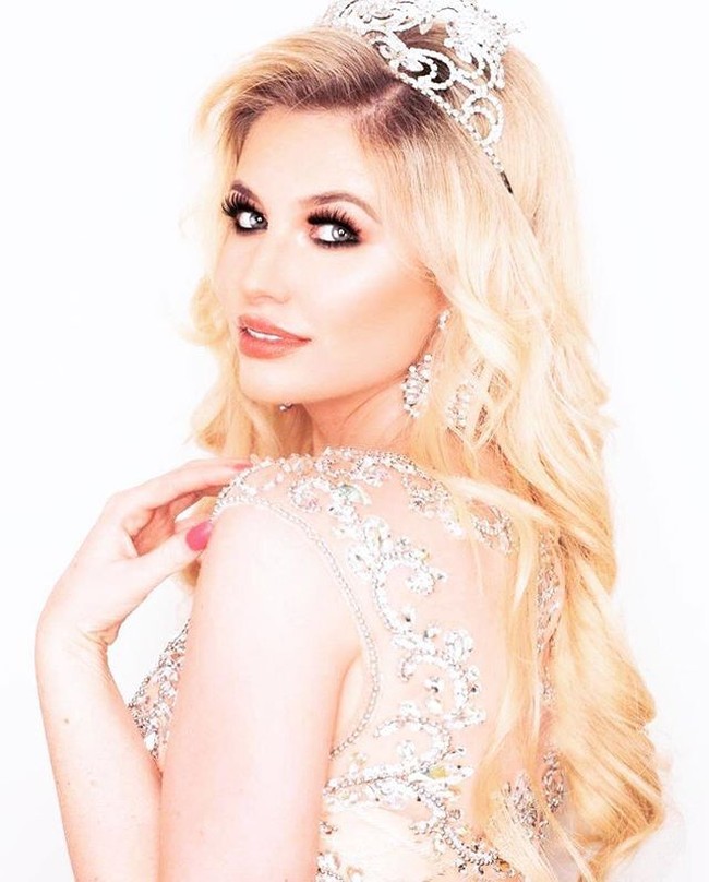 Tak hanya itu, Amy juga merupakan ratu kecantikan. Ia pernah dinobatkan sebagai Miss United Kingdom 2013. (Foto: Instagram/@amyhartxo)