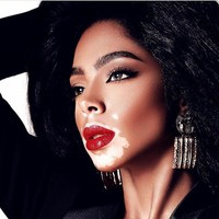 Setelah menjadi model sampul majalah Vogue, Shahad yang juga populer di Instagram dengan followers lebih dari 75 ribu itu berharap bisa menjadi inspirasi. Aku sekarang merasa aku ternyata bisa menginspirasi wanita dari negara lain, katanya. Foto: Instagram @5sunshine1, Vogue Arabia