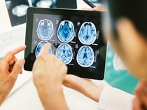 Wanita Curhat Ketahuan Idap Tumor Otak Lewat Foto Selfie, Alami Gejala Ini