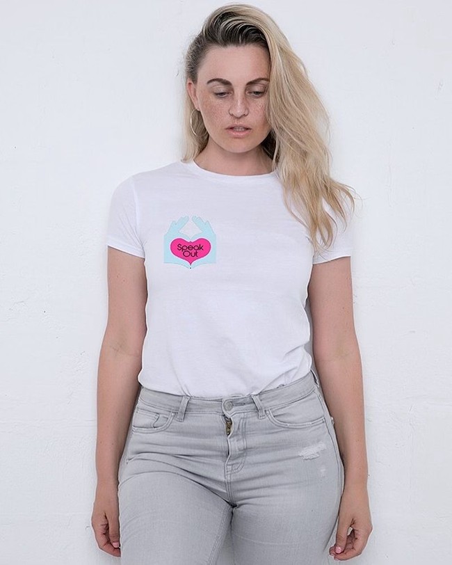 Inilah penampilan Carla terbaru dengan hidung barunya. Hingga kini masih belum jelas apakah tindakannya itu ilegal. Foto: Instagram @officialcarlabellucci