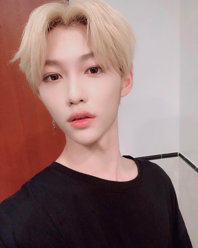 Felix punya bintik-bintik freckle di wajahnya yang membuat wajah pemilik nama Korea Lee Yongbok tersebut semakin imut. Foto: Instagram @realstraykids