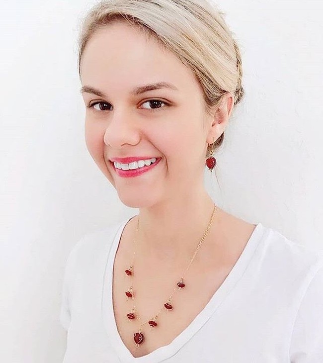 Kami telah dibebani dengan penggambaran buruk ini bahwa orang-orang autis yang sangat cerdas, mereka jenius, atau mereka bodoh, mereka terobsesi. Penggambaran itu tidak menunjukkan kenyataan, ujarnya. Foto: Instagram/@rachelbarcellona