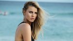 Potret Eks Miss Universe Aussie yang Sempat Disebut Telantar di Bali