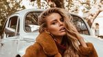 Potret Eks Miss Universe Aussie yang Sempat Disebut Telantar di Bali