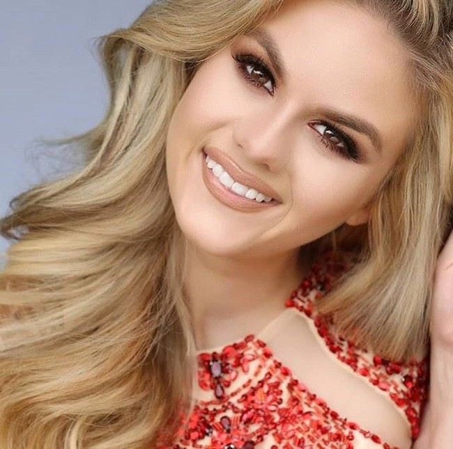 “Aku membawa pesan harapan. Itulah yang selalu kulakukan. Bahkan jika kamu memiliki cacat jenis apa pun, itu seharusnya tidak menghentikanmu dari mencapai impianmu, terang Rachel. Foto: Instagram/@rachelbarcellona