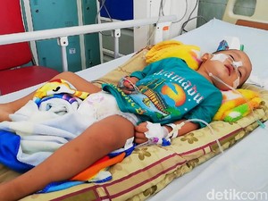 Kisah Pilu Radika, Bocah Pasuruan Dibiarkan Koma karena Radang Otak