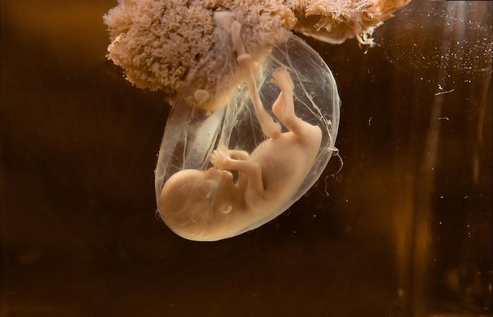 Unborn human embryo model for education purpose