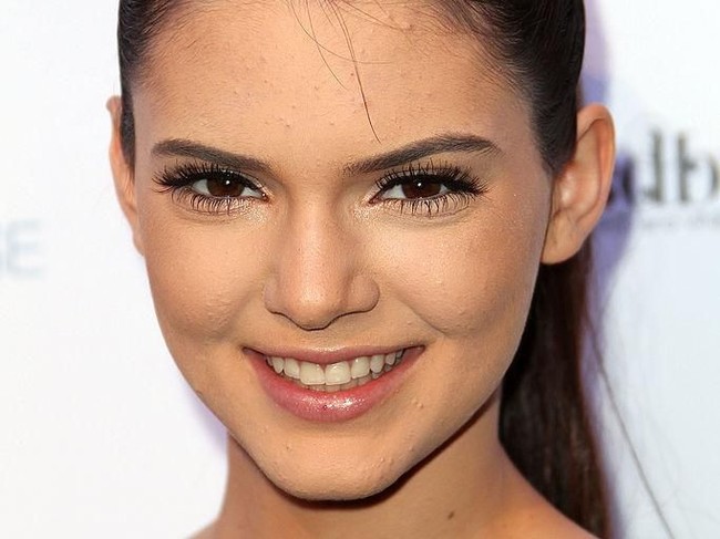 Bisa mengindikasikan kalau dia menjalani rhinoplasty (pembentukan hidung), yang membuat hidungnya terlihat sangat natural, ujarnya. Ini foto Kendall Jenner di 2010, saat ia masih remaja. Foto: Getty Images